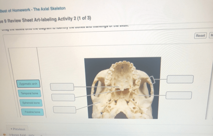 Exercise 9 the axial skeleton answers